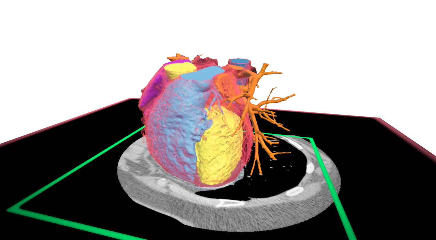 3D virtual reality rendering of a heart in collaborative research.
