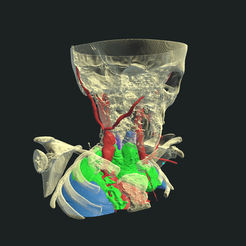 Review and refine understanding of complex cases