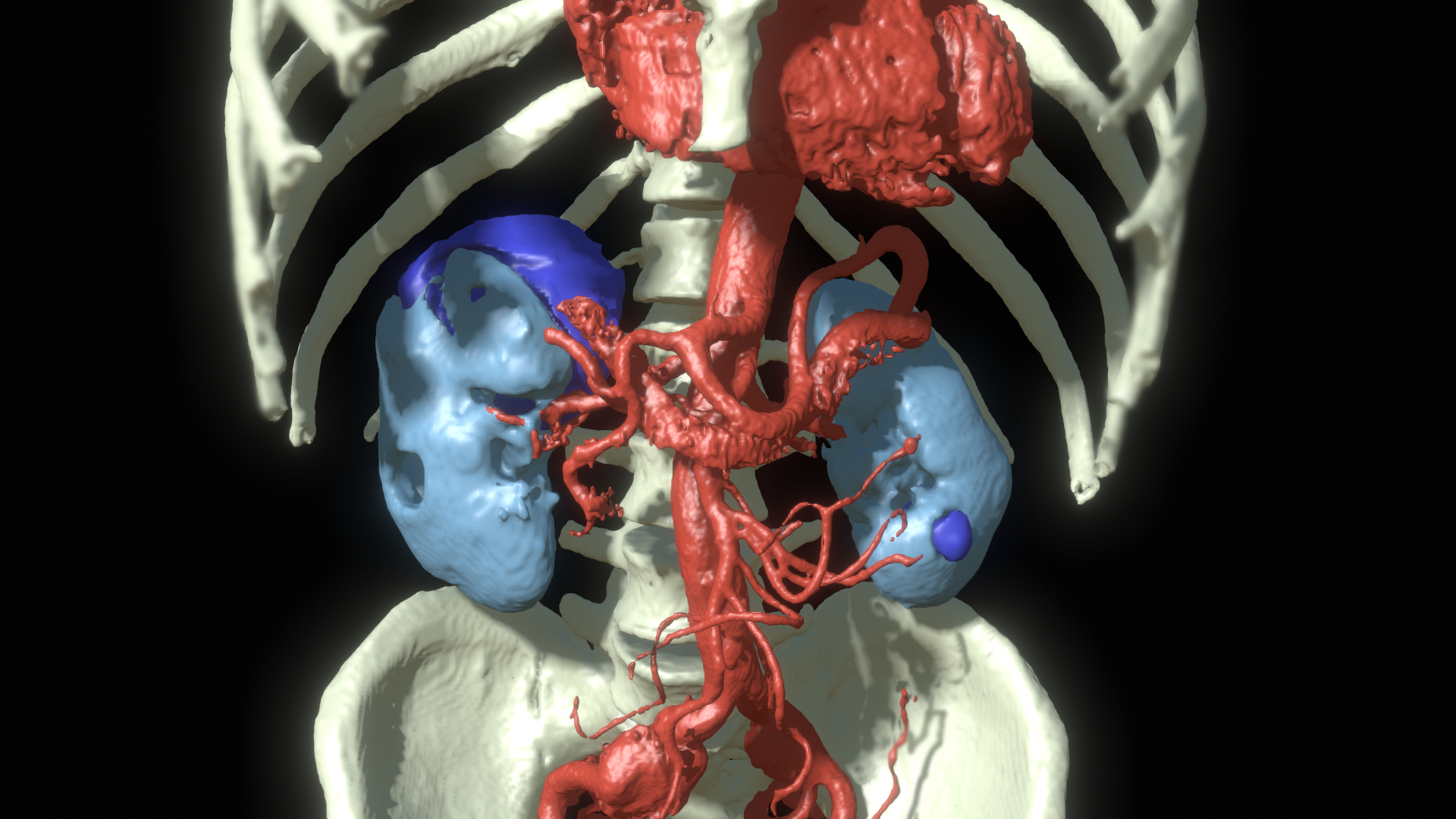 Clinician wearing a VR headset interacting with a 3D anatomical model.
