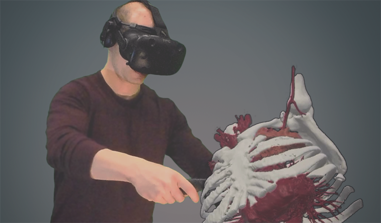 A user interacting with a 3D printing medical model in virtual reality