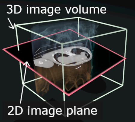 A 3D CT scan intersecting a visualization plane in VR
