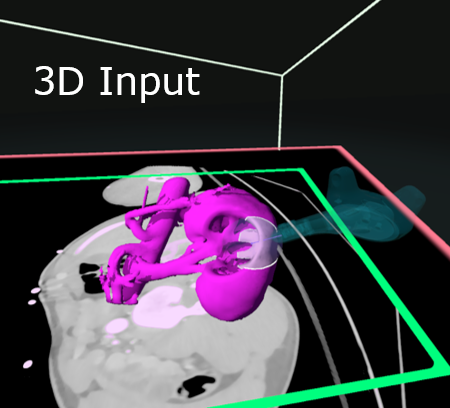 A VR stylus drawing on a 3D medical model with a CT image