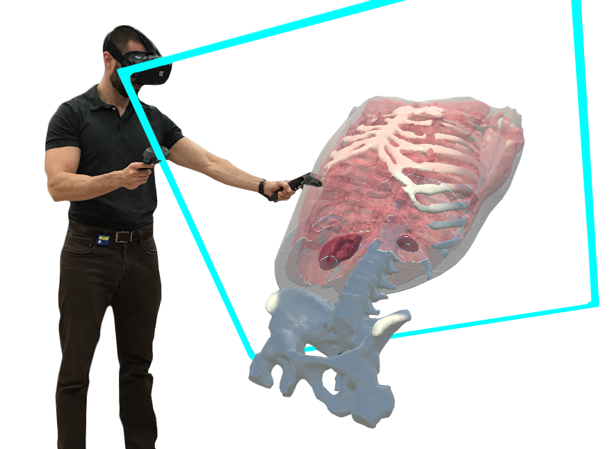 A VR user manipulating a 3D medical model in virtual reality