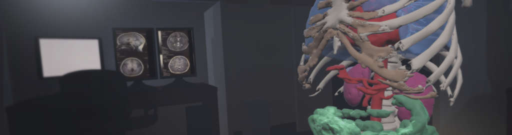 A virtual reality scene of a 3D medical model in a radiology reading room